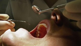 [UGCHAR-CJ]Trip to Dentist Can Help Detect Oral Cancer Early | NBC Connecticut https://t.co/FokcDcbebG via @nbc