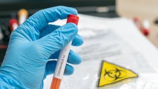 Close up of microbiologist hand with surgical gloves holding a blood test tube for coronavirus. Test tubes with blood sample for covid-19 virus, biohazard transportation bag