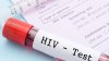 Departamento de Salud ofrece pruebas gratuitas de VIH en El Paso