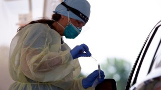 Prueba del coronavirus (COVID-19)