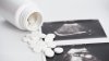 Kansas: proveedores de servicios de aborto demandan a por nueva regla de medicamentos