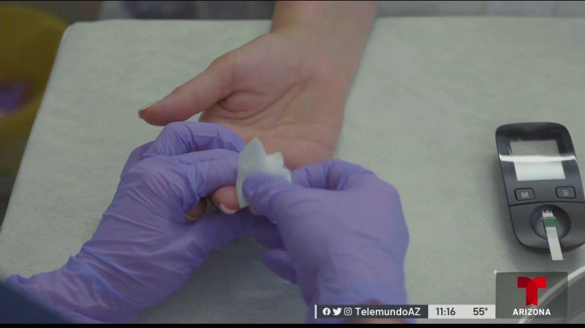 Revelan que el VIH mutó a una variante más contagiosa