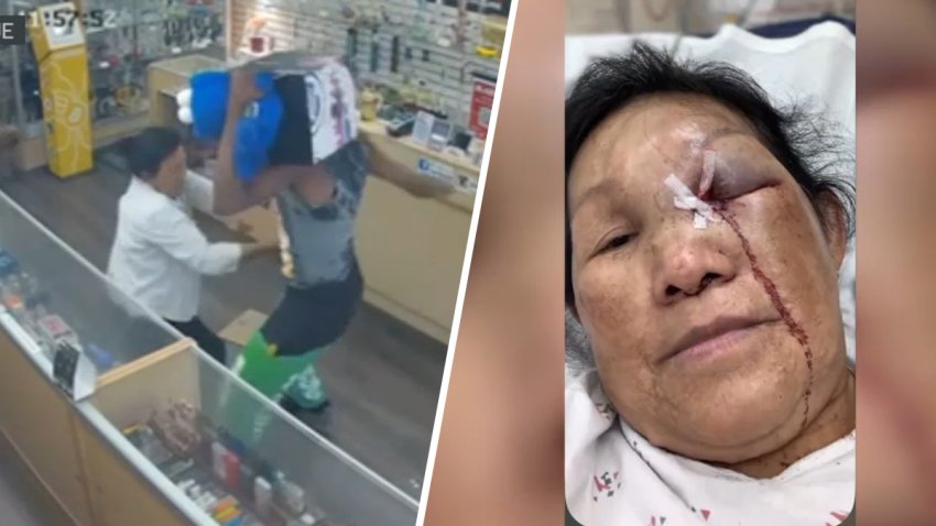 Left: A robber punches Van Huynh. Right: Van Huynh in a hospital bed with a swollen left eye.