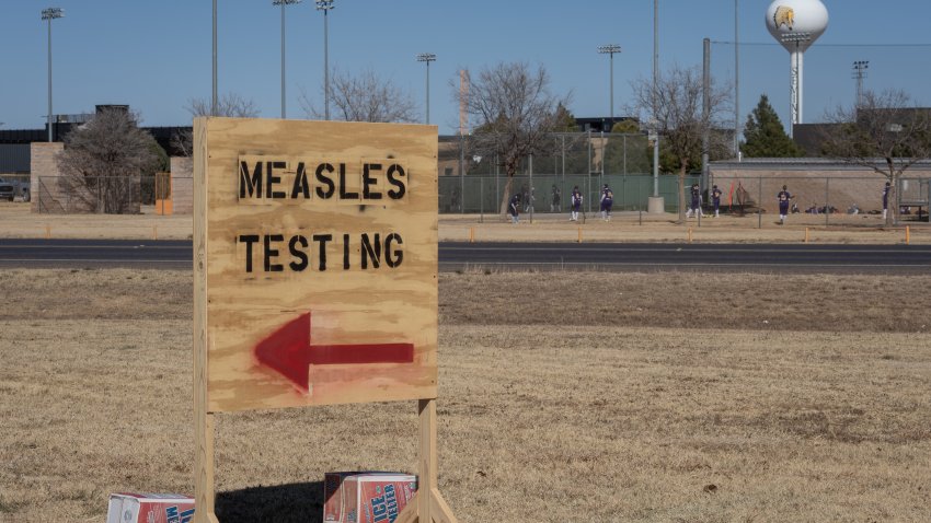 SEMINOLE, TEXAS – 27 DE FEBRERO: Señales indican el camino a las pruebas de sarampión en el estacionamiento del Distrito Hospitalario de Seminole frente al Estadio Wigwam el 27 de febrero de 2025 en Seminole, Texas.